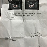 孕9周+2天胚胎胚芽发育正常，做了两次彩超都没胎心，医生建议手术。我和我老公还在坚持这正常吗急急急急...