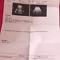 应大家要求把结果发出来 今天去医院做B超确定了 是有了 六个多月了 他们不准备要 公公还在外地上班 等明...