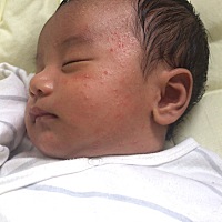 各位宝妈😟，这是湿疹吗，该咋办