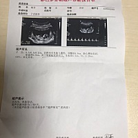 刚怀孕做B超看不到胎芽，紧张一回，12周做NT发现胎盘紧贴宫颈口，这又得让为娘的紧张好一会了，真是个真...