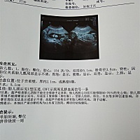 大家猜猜看是男宝女宝，好奇心太强