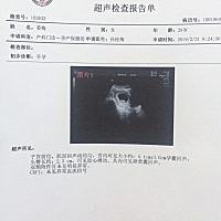 八周➕4的时候做的B超 ，宝妈们有没有会看的啊，我想要佩奇 我想要闺女 🙏