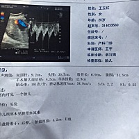 37周，还是有点小！一直都偏小呀