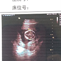 圆形是闺女，可信不？