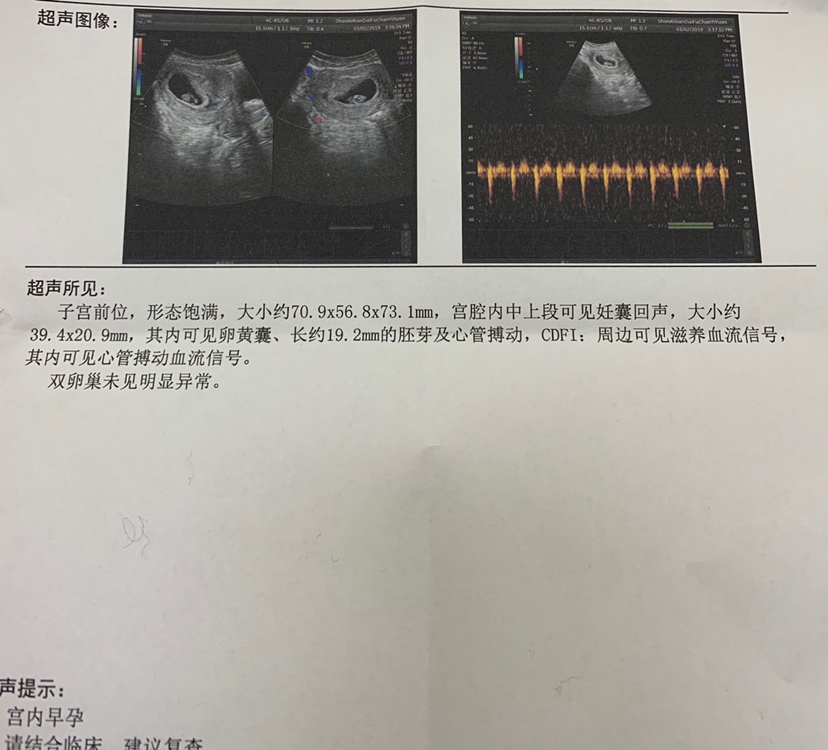 能看出来是不是佩奇吗？