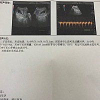 能看出来是不是佩奇吗？