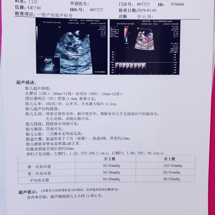 NT过！！