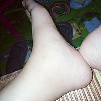 怀孕八个多月脚肿了怎么回事呀？