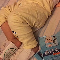 宝贝这几天咳嗽有痰，昨天喝了益生菌加上贴灸！今天咳嗽就好多了！痰也少多了！今天继续贴灸巩固一下！...