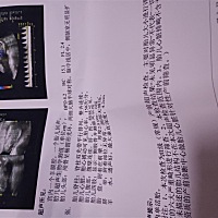 怀孕4个多月，今天照了彩超一切正常，就是不知道男女，会看的帮忙看看，肚子是平躺的照的