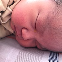 宝宝眼睛有黄色眼屎，都把眼睛糊住了睁不开了，拿了眼药水感觉也不大管用，还红红的，好像肿了。听说这...