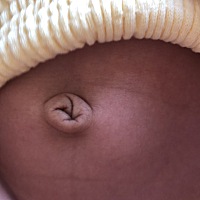 40多天的宝宝肚脐这样正常吗