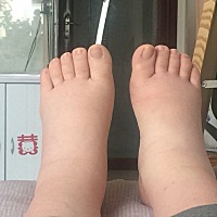 感觉整个人变好丑啊 鼻子也变大了 皮肤也变黄了 整个人又胖又虚又肿 。希望宝宝健健康康。生完样子还能...