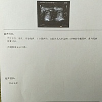 求解？表示看不懂！我就想知道大概多久了？