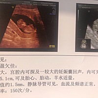 帮忙亲们看下是男宝还是女宝呢