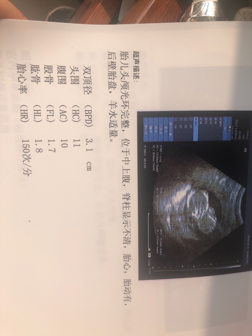 帮忙亲们看下是男宝还是女宝呢