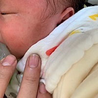 这块黑黑的是胎记吗？😭😭😭