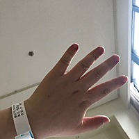 住院当天的手和生完宝宝的手 顺转剖女宝宝一枚。真的催产太疼了 一天一夜的疼只开了三指，太痛苦了...