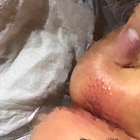 宝宝屁股口长的这是什么