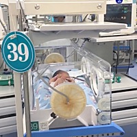 3月2日刨腹产，女孩子，因为小孩子缺氧，所以提前刨腹产卸货了，小孩子刚好36周，还没足月，4.4斤，在手...