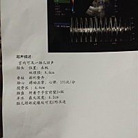 37周做的彩超 医生说胎盘过早成熟 不知道有没有相同情况的孕妈