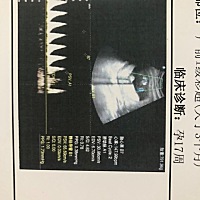 不会看B超，懂的人帮忙看看