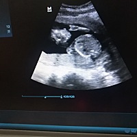 今天第二次产检，医生说四个月就吃手指了，我都觉得不可思议，厉害了。