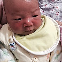 两个月的宝宝生下来天天下雨，都没见过太阳，昨天天晴了，晒了一上午，结果晚上脸成这样了（下面那张是...