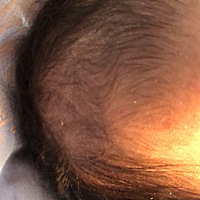 宝宝头皮干，有点掉头发，怎么回事