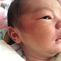 有没有同样经历的宝妈？宝宝出生16天了，从出生就带有一块红色的，不知道是什么，想求助各位知道的宝妈...