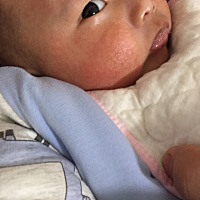 宝宝脸上湿疹怎么办