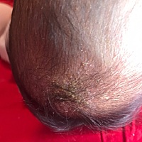 宝宝头上是什么？他吃奶的时候一直抓