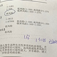 唐氏筛查1：226 医生说高风险，昨天去抽了血做无创DNA检查，结果还没出来，现在等结果的每天都很担心，...