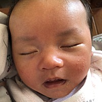 50天了黄疸还没退完 烦 各位宝妈有什么办法吗？