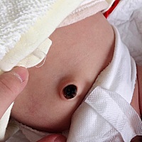 宝贝肌带如何护理？ 多可爱的猪猪啊，但是肌带15天还没有脱落，想问下有经验的宝妈，这个一般要多久脱落...