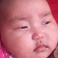 亲，这是不是湿疹？