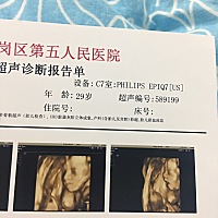 我跟老公第一次看到宝宝容颜，感觉跟谁像点……第四张照片，宝宝打哈欠，医生送的，给我们当纪念呢