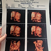 耶，四维一次通过，猜猜这是男宝还是女宝呢？