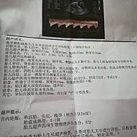 帮我看看男孩还是女孩，想要一个男孩，