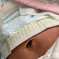 宝宝出院没几天肚脐就掉了，现在成这样了，今天换尿不湿的时候发现衣服上有一点血迹，新生儿的肚脐应该...