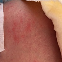 宝妈们帮我看下宝宝长得啥