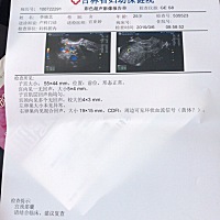 亲们能帮我看看怎么回事么？