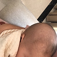 为什么宝宝的头发是这样长的，是不是缺啥维生素呢？