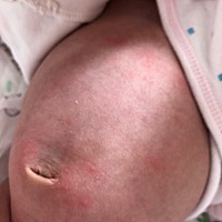 宝宝肚子上有几处红点点，有知道吗