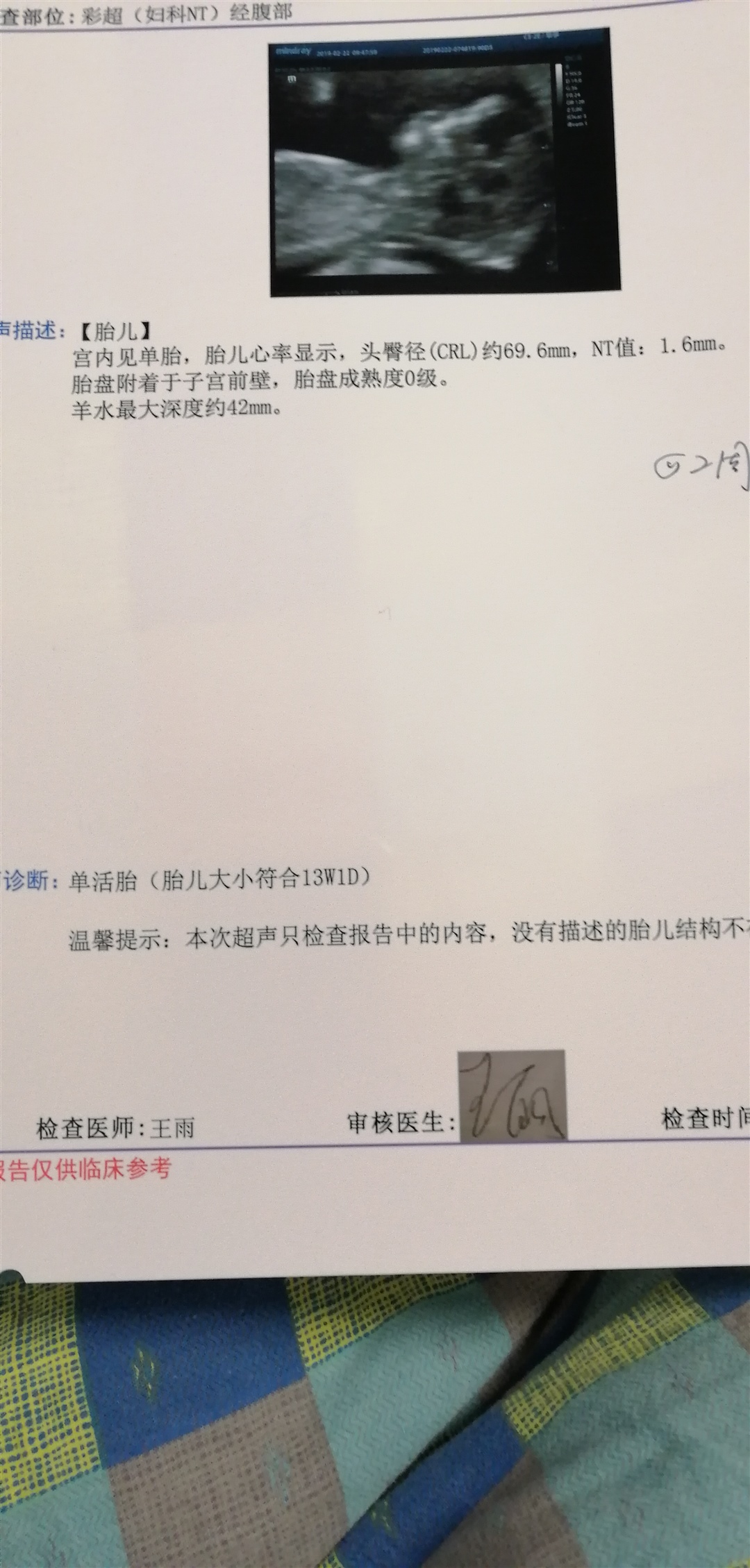 我也想知道是男孩，还是女孩？