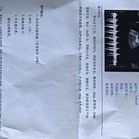 怀孕16周了，今天去做了彩超！谁能看看是男是女？好期待