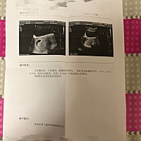 谁会看男孩还是女孩？帮忙看一下