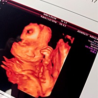 感觉不像我😭😭😭😭😭😭😭😭😭好丑哦  不过还是很期待59天后天出来会咋样