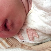 宝宝的小嘴吸奶吸成这样了，要不要停止让她自己吸啊？