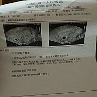 医生说宝宝胎位比较偏右边，让即使复查呢。希望我家宝贝可以安全出生，爸爸和妈妈都很期待你的到来呢。...